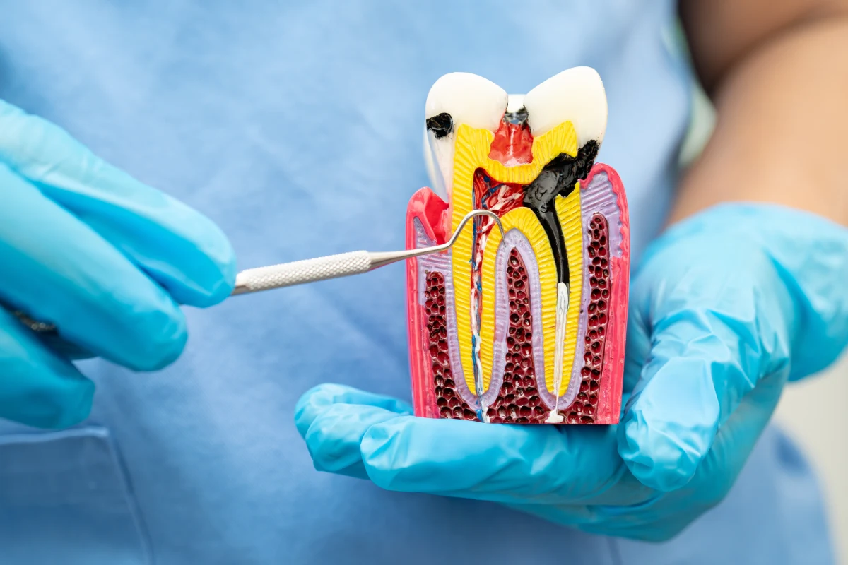 Endodonzia - Studio Dentistico Green Smile