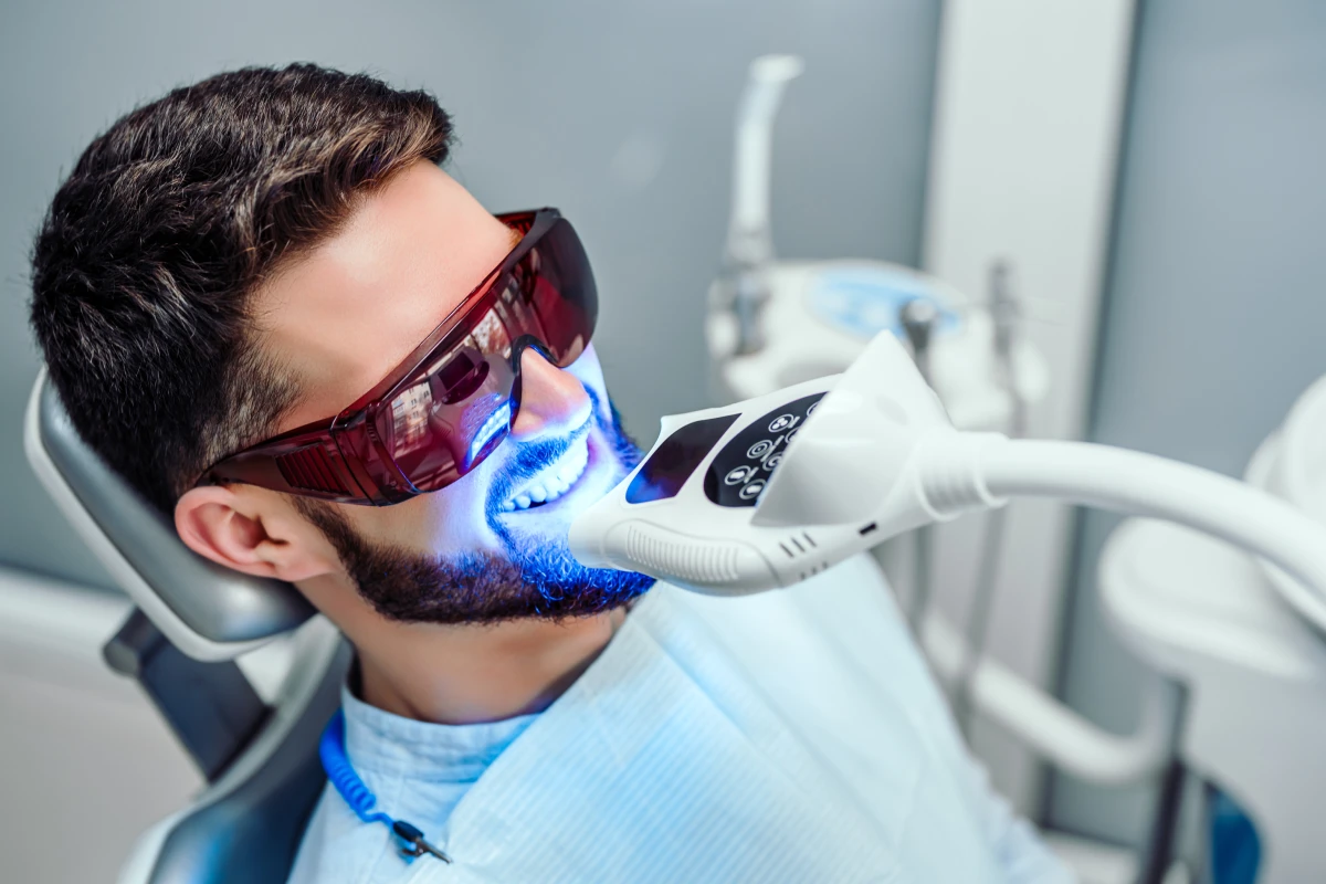 Sbiancamento denti - Studio Dentistico Green Smile