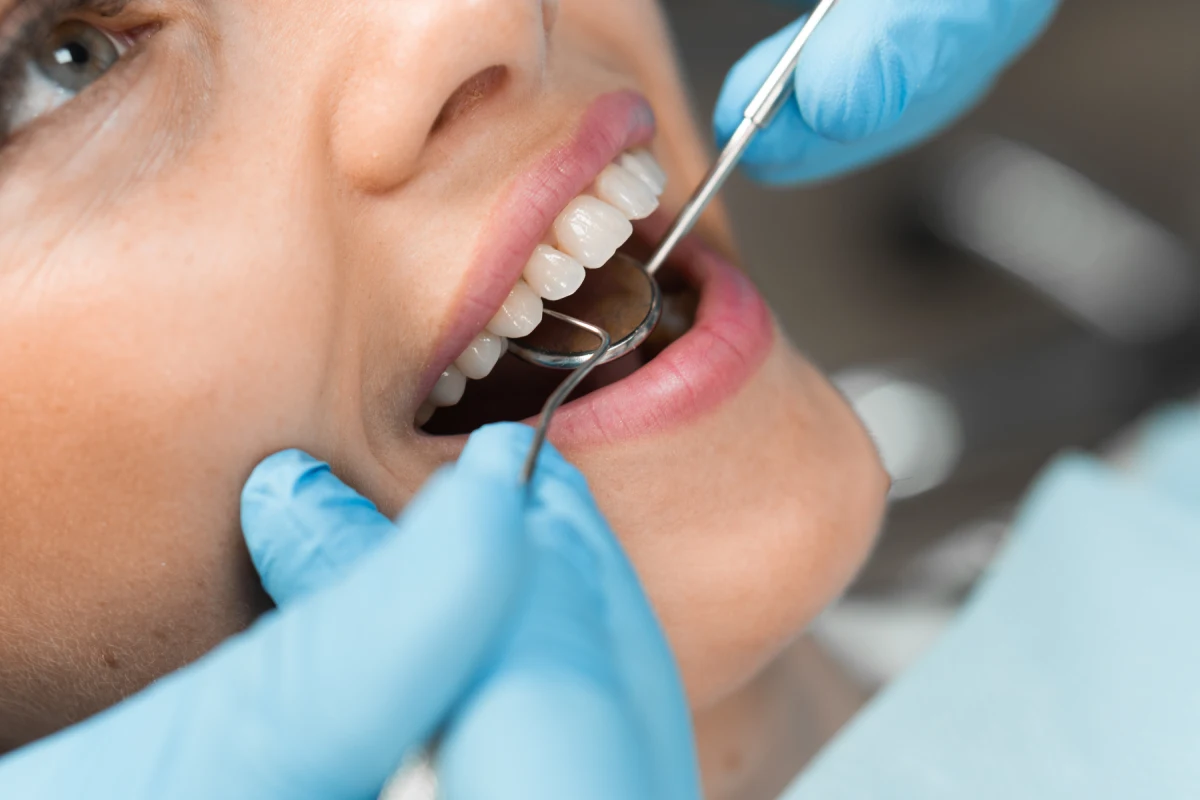 Terapia conservativa - Studio Dentistico Green Smile